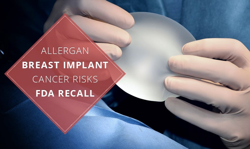 Aviso de la FDA sobre la retirada del mercado de implantes mamarios de Allergan debido a riesgos de cáncer