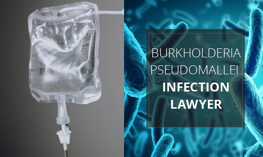 Imagen sobre asistencia jurídica para la infección por Burkholderia pseudomallei