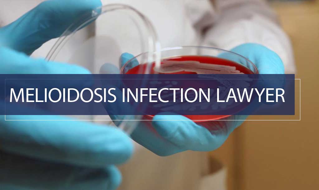Abogado especializado en casos legales relacionados con la melioidosis
